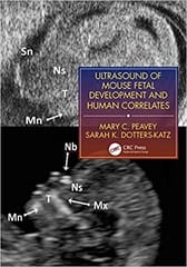 Ultrasound Of Mouse Fetal Development And Human Correlates 2021 By Peavey Mary C
