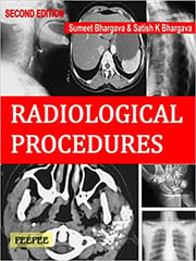 Radiological Procedures 2nd Edition 2016 By Bhargava