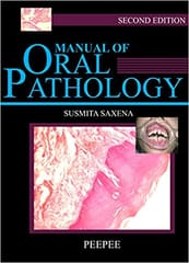 Manual Of Oral Pathology 2nd Edition 2017 By Sushmita Saxena