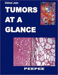 Tumors At A Glance For Dm Oncology 1st Edition 2013 By V K Jain