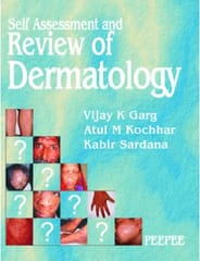 Self Assessment And Review Of Dermatology 1st Edition 2006 By Vijay Garg