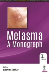 Melasma A Monograph 3rd Edition 2022 By Rashmi Sarkar