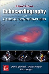 Practical Echocardiography For Cardiac Sonographers 2020 By Shindler D M