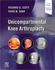 Unicompartmental Knee Arthroplasty 1st Edition 2022 By Scott