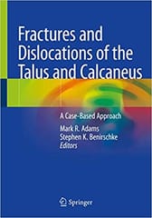 Adams M R Fractures And Dislocations Of The Talus And Calcaneus A Case Based Approach 2020
