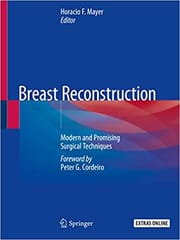 Mayer H F Breast Reconstruction Modern And Promising Surgical Techniques 2020