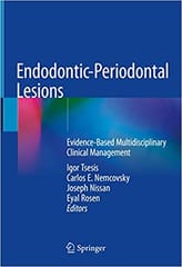 Tsesis I Endodontic Periodontal Lesions Evidence Based Multidisciplinary Clinical Management 2019