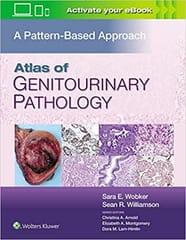 Wobker S E Atlas Of Genitourinary Pathology A Pattern Based Approach 2021