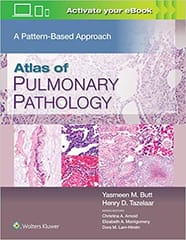 Butt Y M Atlas Of Pulmonary Pathology A Pattern Based Approach With Access Code 2021