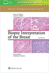 Schnitt S J Biopsy Interpretation Of The Breast With Access Code 3rd Edition 2018