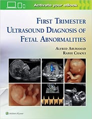 Abuhamad A Z First Trimester Ultrasound Diagnosis Of Fetal Abnormalities 2018