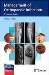 Chen Management of Orthopaedic Infections A Practical Guide 1st Edition 2021