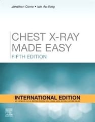Corne J Chest X Ray Made Easy 5th Edition 2023