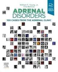 Young W F Adrenal Disorders 100 Cases From The Adrenal Clinic With Access Code 2022