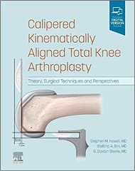 Howell S M Calipered Kinematically Aligned Total Knee Arthroplasty Theory Surgical Techniques And Perspectives 2022
