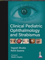 Yogesh Shukla Clinical Pediatric Ophthalmology And Strabismus 1st Edition 2023