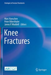 Hanschen M Knee Fractures 2021