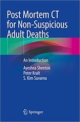 Shenton A Post Mortem Ct For Non Suspicious Adult Deaths An Introduction 2021