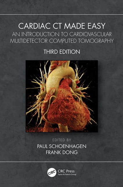 Paul Schoenhagen Cardiac CT Made Easy An Introduction to Cardiovascular Multidetector Computed Tomography 3rd Edition 2022