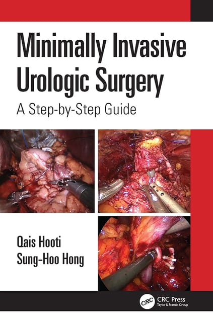 Qais Hooti Minimally Invasive Urologic Surgery: A Step-by-Step Guide 1st Edition 2022
