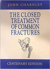 The Closed Treatment Of Common Fractures by Charnley 2019