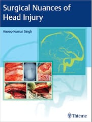 Surgical Nuances Of Head Injury With Access Code 2023 By Singh AK