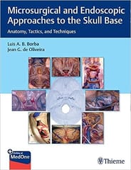 Microsurgical and Endoscopic Approaches to the Skull Base Anatomy, Tactics, and Techniques 2021 By Luis Borba