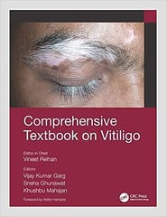 Comprehensive Textbook On Vitiligo 2022 By Relhan V