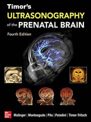 Timor's Ultrasonography of the Prenatal Brain 4th Edition 2023 By Ilan Timor-Tritsch