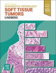 Diagnostic Pathology Soft Tissue Tumors With Access Code 4th Edition 2023 By Matthew R. Lindberg