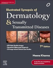 Illustrated Synopsis of Dermatology & Sexually Transmitted Diseases 7th Edition 2023 by Neena Khanna