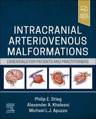 Intracranial Arteriovenous Malformations Essentials For Patients And Practitioners With Access Code 2024 By Philip E. Stieg