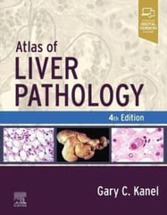 Atlas Of Liver Pathology With Access Code 4th Edition 2024 By Gary C. Kanel
