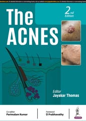 The Acnes 2nd Edition 2024 By Jayakar Thomas
