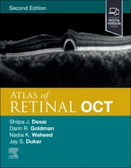 Atlas of Retinal OCT 2nd Edition 2023 By Jay S Duker