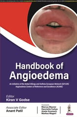 Handbook Of Angioedema 1st Edition 2024 By Kiran V Godse