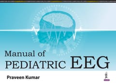 Manual Of Pediatric Eeg 1st Edition 2024 By Praveen Kumar