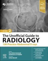 The Unofficial Guide to Radiology 100 Practice Abdominal X-rays 2nd Edition 2024 By Patrice Eastwood