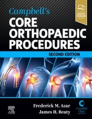 Campbells Core Orthopaedic Procedures 2nd Edition 2024 By Frederick M Azar