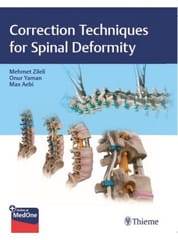 Correction Techniques for Spinal Deformity 1st Edition 2023 By Zileli