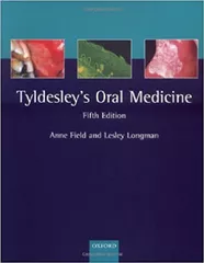 Tyldesley Oral Medicine 5th Edition By  Anne Field