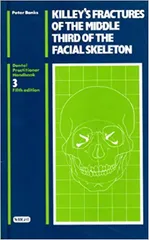 Fractures of the Middle Third of the Facial Skeleton 3rd Edition By Peter Banks