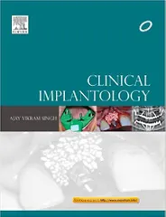 Clinical Implantology 1st Edition 2013 By Ajay Vikram Singh