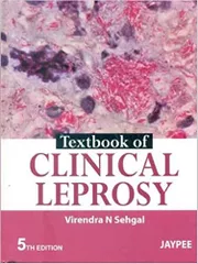 Textbook of Clinical Leprosy 5th Edition 2013 By Virendra N Sehgal