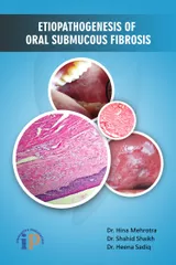 Etiopathogenesis of Oral Submucous Fibrosis, First Edition, 2017, By Dr. Hina Mehrotra, Dr. Shahid Shaikh, Dr. Heena Sadiq