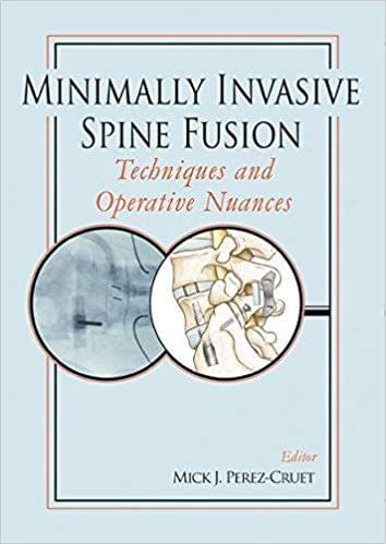 Minimally Invasive Spine Fusion: Techniques and Operative Nuances 1st Edition 2011 By Mick Perez-Cruet
