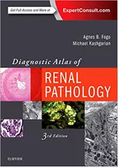 Diagnostic Atlas of Renal Pathology 2016 By Agnes B. Fogo