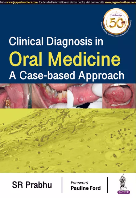 Clinical Diagnosis in  ORAL MEDICINE A Case-based Approach 1st Edition 2019  By SR Prabhu