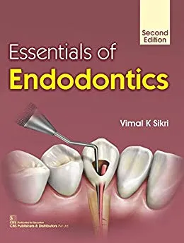 Essentials of Endodontics 2nd Edition 2019 By Vimal K. Sikri