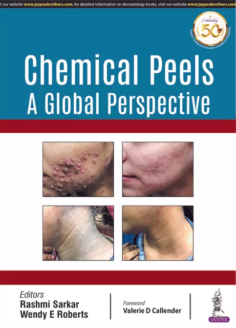 Chemical Peels A Global Perspective 1st edition 2019 By Rashmi Sarkar & Wendy E Roberts